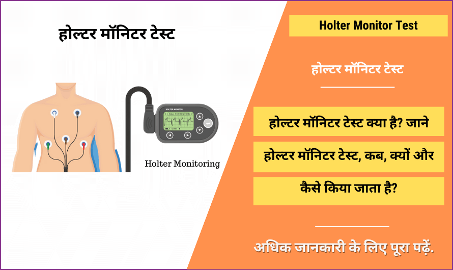 होल्टर मॉनिटरटेस्ट टेस्ट – Holter Monitor Test in Hindi