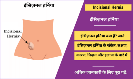 Incisional Hernia in Hindi