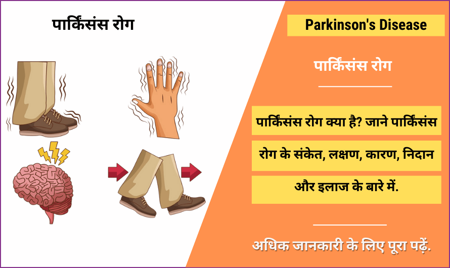 पार्किंसंस रोग – Parkinson’s Disease in Hindi