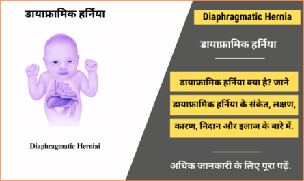 Diaphragmatic Hernia in Hindi