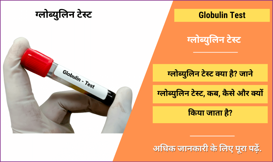 ग्लोब्युलिन टेस्ट – Globulin Test in Hindi