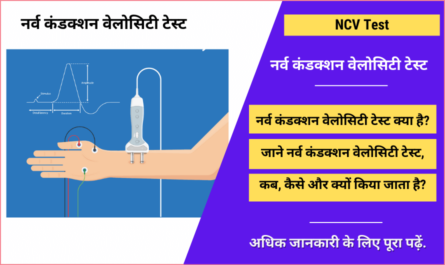 Nerve Conduction Velocity (NCV) Test in Hindi