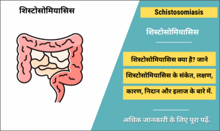 Schistosomiasis in Hindi