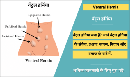 Ventral Hernia in Hindi